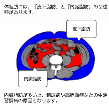 皮下脂肪と内臓脂肪