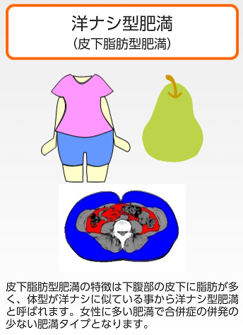 洋ナシ型肥満